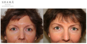 Shamá 3D Permanent Eyebrow, Före & efter bild.